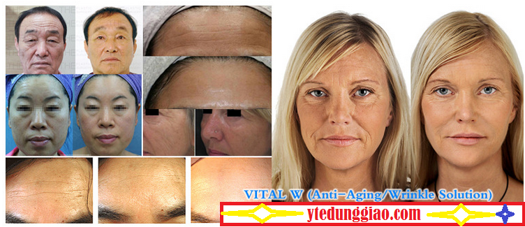 kim lăn tế bào gốc hàn quốc